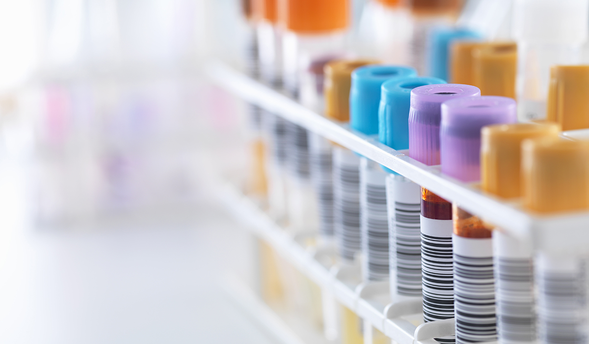 A Row Of Human Samples For Analytical Testing Including Blood, Urine, Chemistry, Proteins,anticoagulants And HIV In Lab