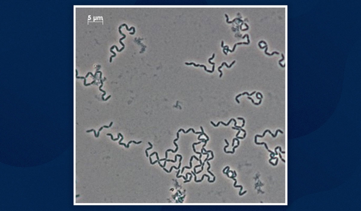 Gut