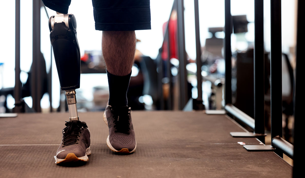 Leg