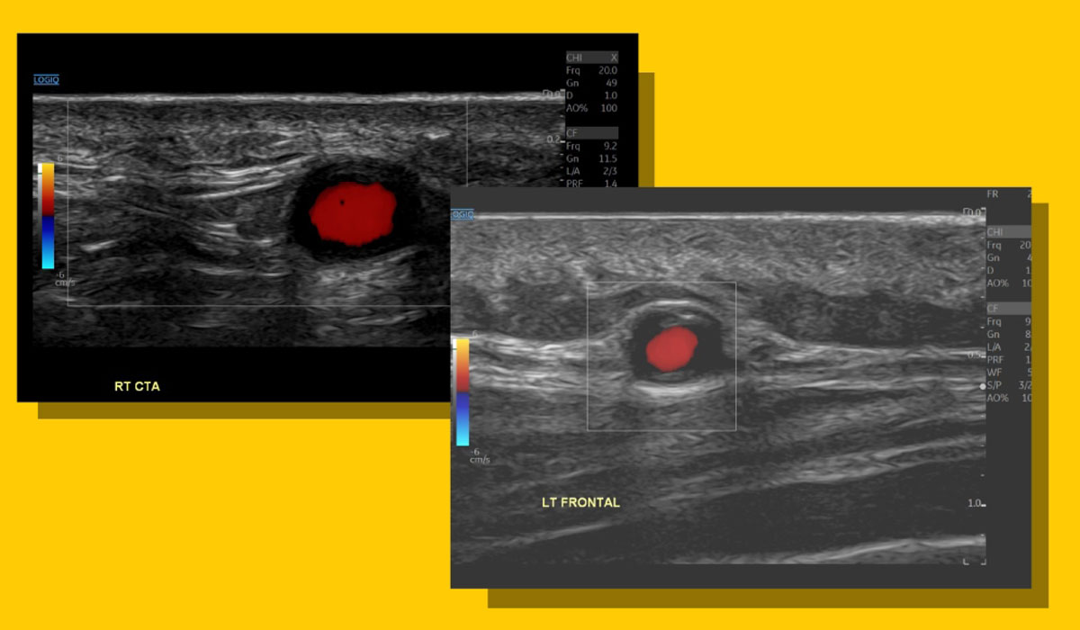 V2Ultrasound