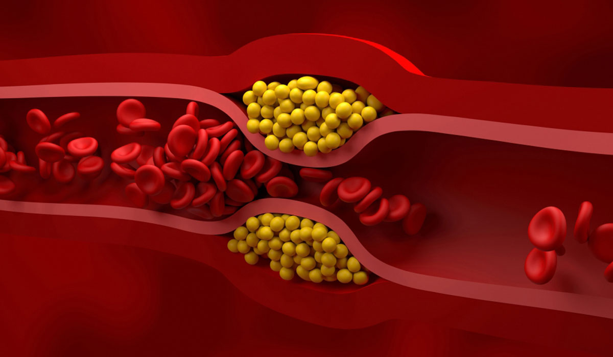 V2blood Cells