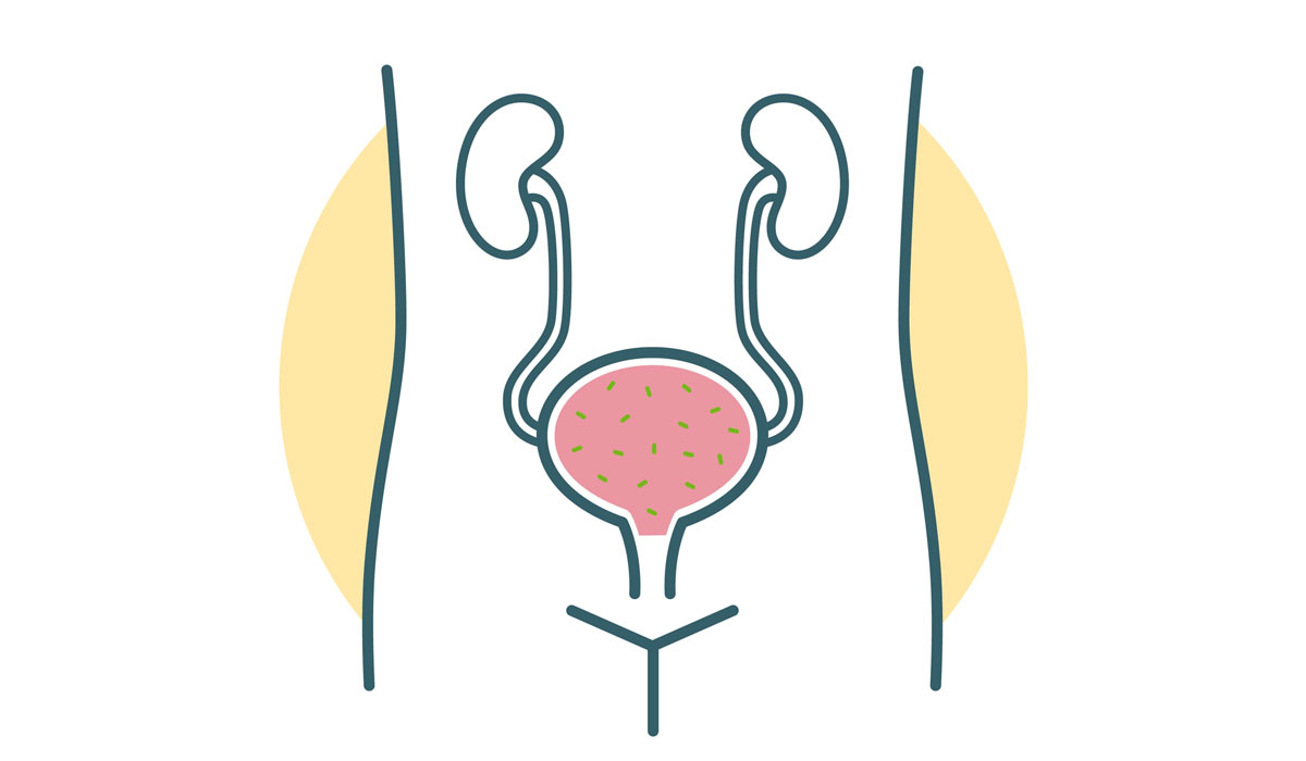 Bladder Wash Kidneys Uti Bacteria