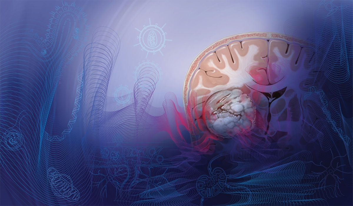 Brain Glioblastoma Cells Scientific Illustration