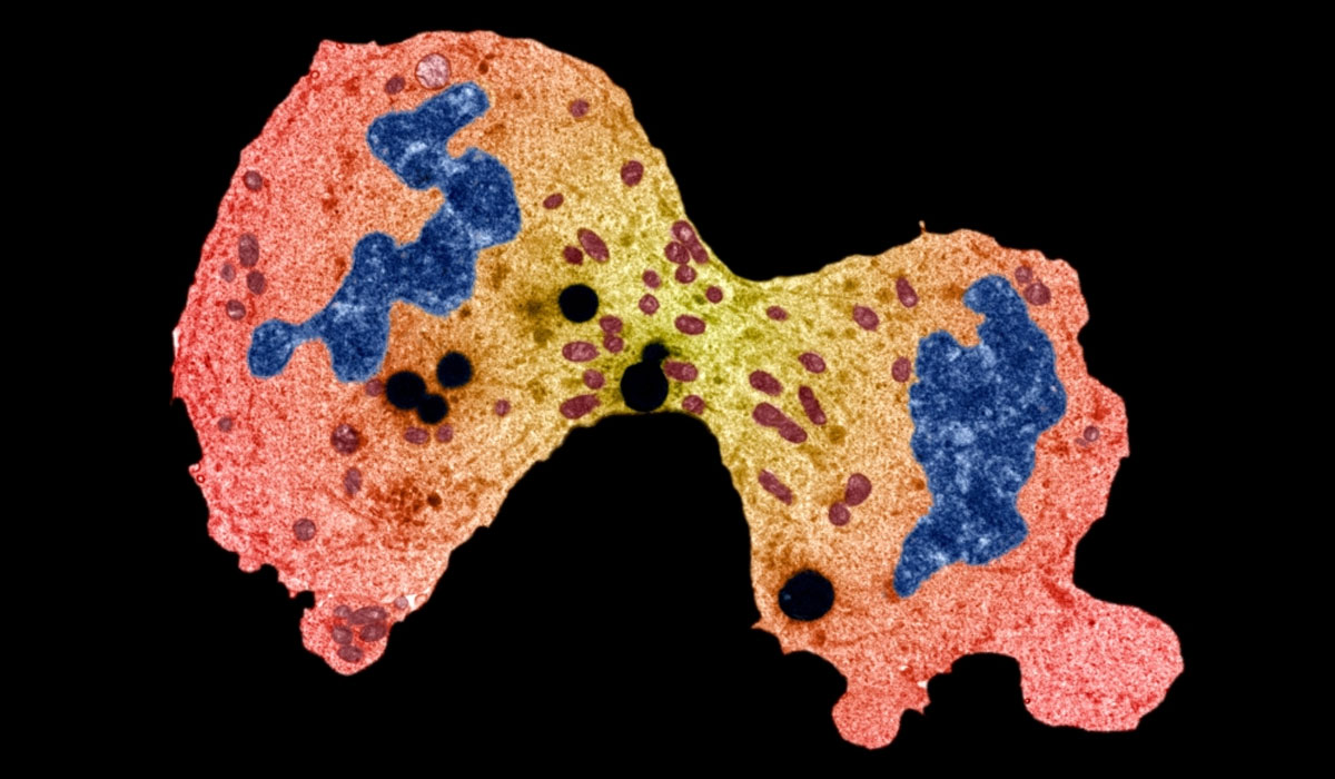 Cancer Cell Dividing Mitosis Microscopic