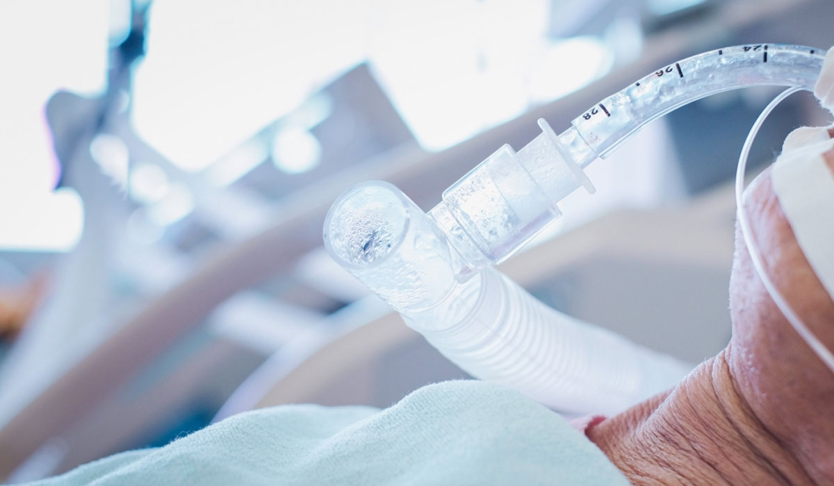 Feeding Tube Unconscious Patient Breathing