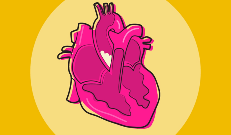 what-is-heart-disease-alumni-association-of-the-university-of-michigan