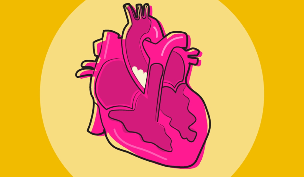 Heart Disease Plaque Hellow Valveartboard 1 100 0