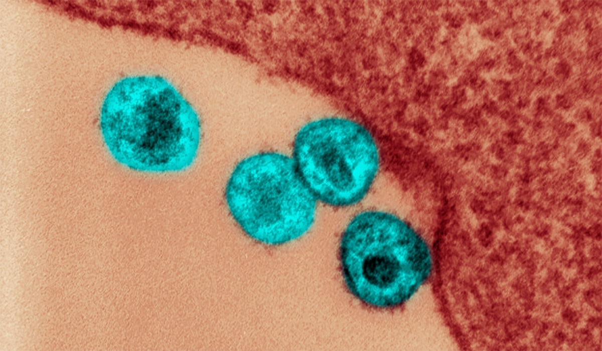 Hiv Virus Cells Microscopic Electron