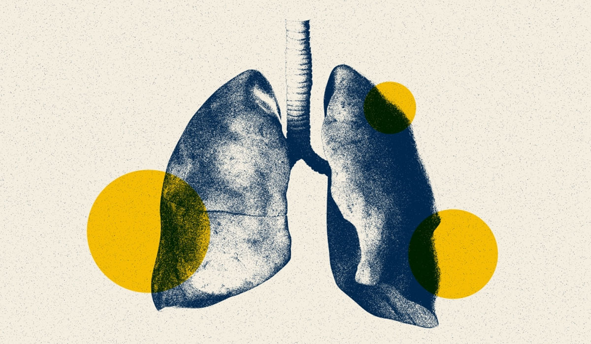 Lungs 1