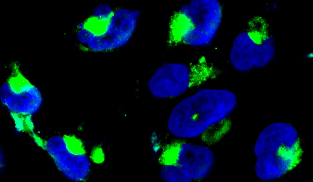 Nanoparticles Glioma Cell Nuclei Green 0