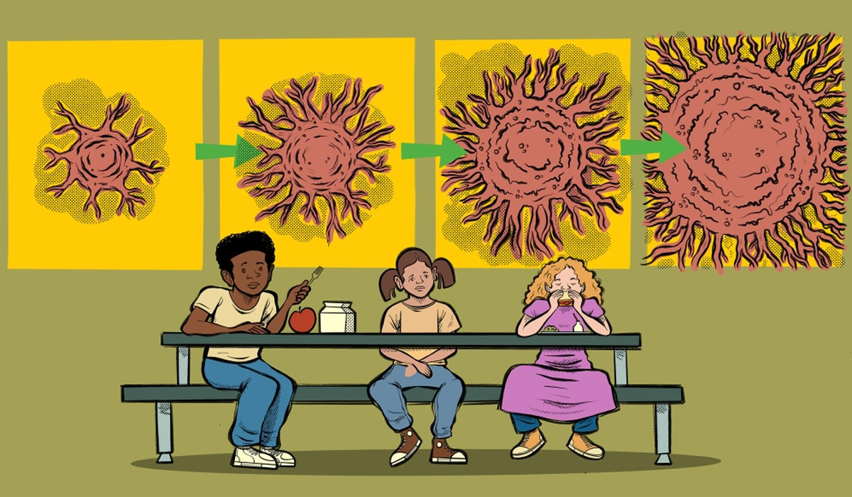Neuroblastoma Tumor Food Insecurity Yellow