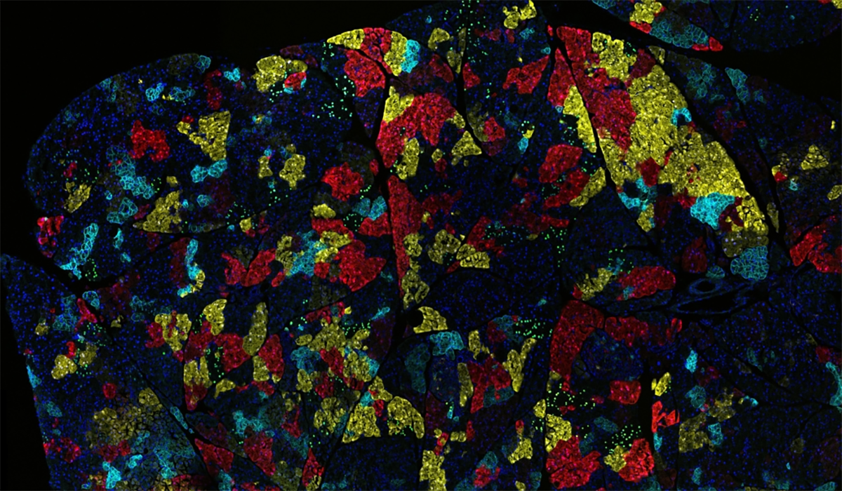 Pancreas Cancer Cells Rainbow Mosaic