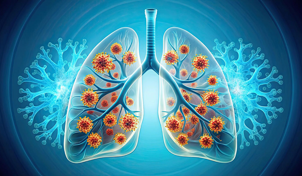 Rsvs Hidden Toll Adults Of All Ages May Struggle With Breathlessness Daily Activities Months After Hospitalization 1536x864