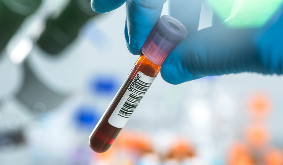 Technician Blood Human Samples Screening