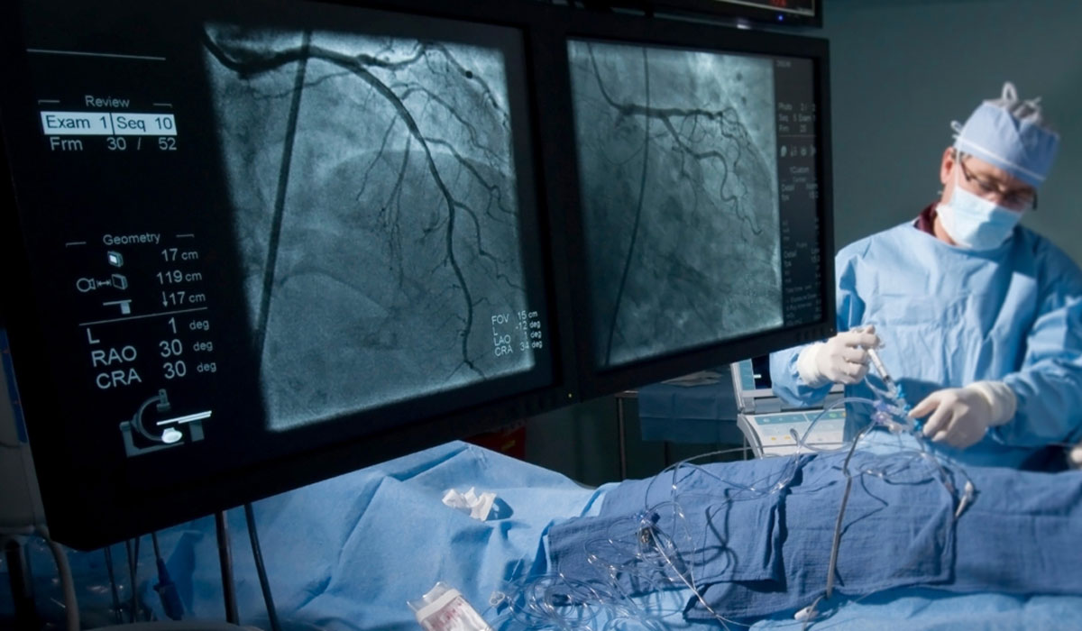 V2surgeon Doctor Surgery Cardiac Catheter