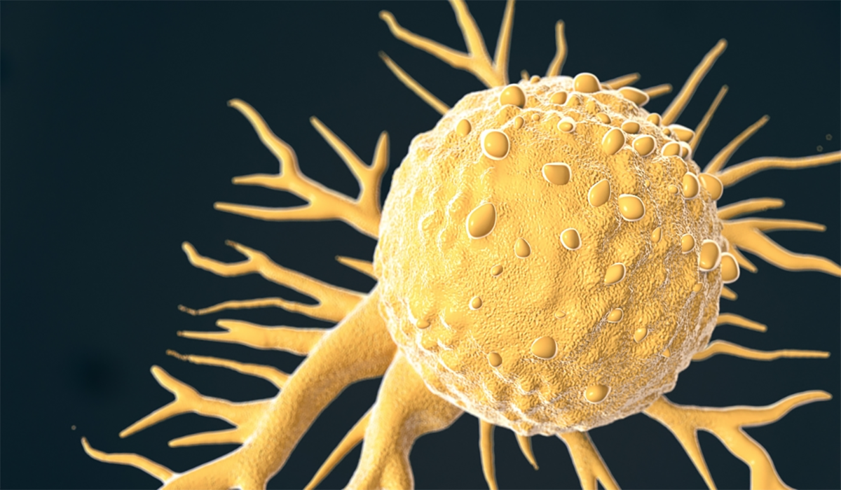 Yellow Cancer Cell